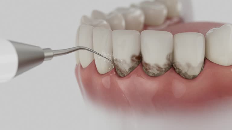 Reliable Dental contractor in Anaheim, CA by Smile Center Dentistry